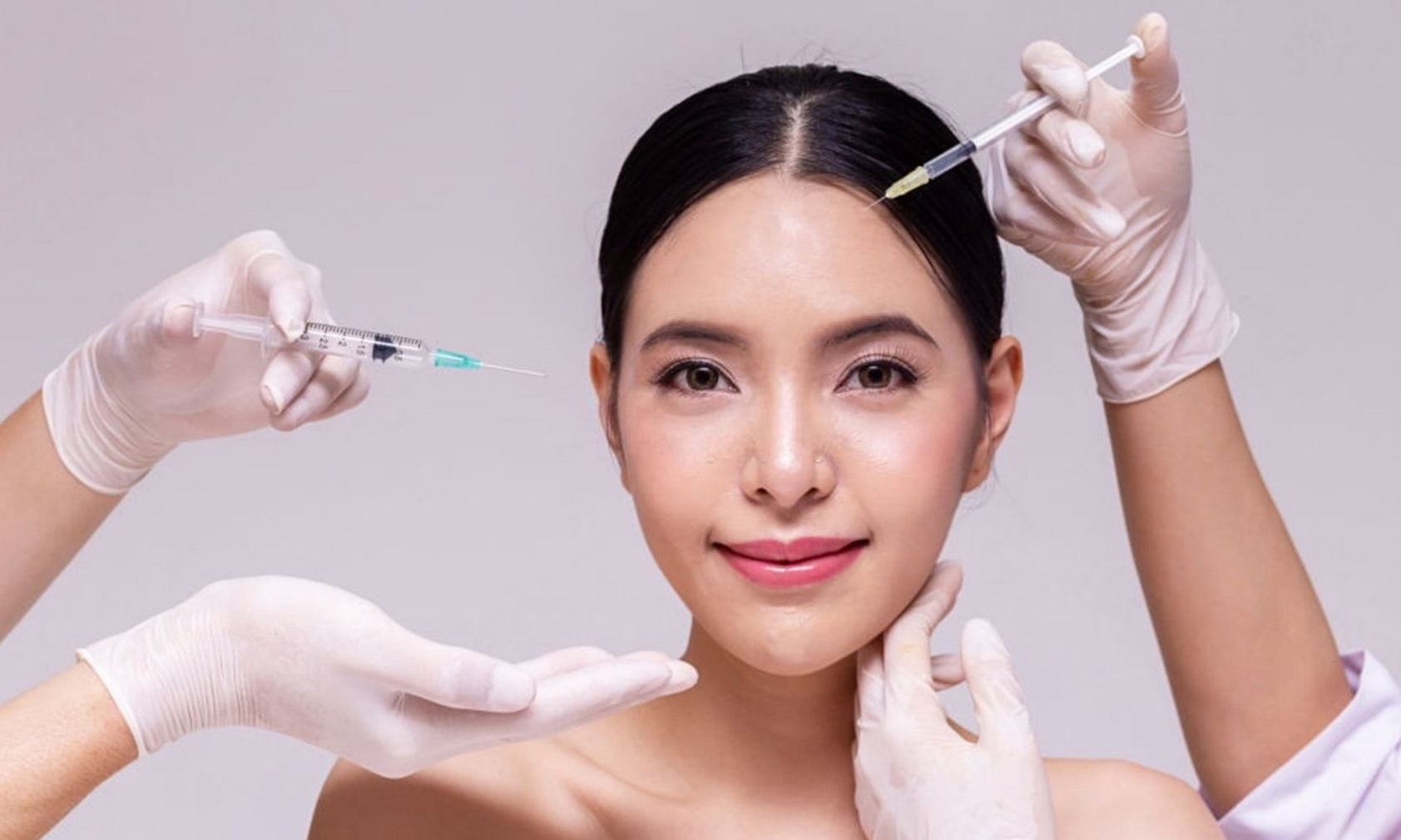 BOTOX TRÁN 4 LẦN